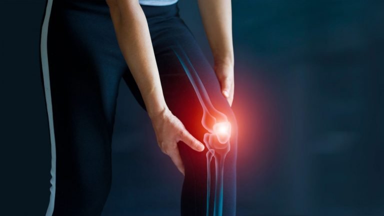 Read more about the article Top 5 myths about arthritis